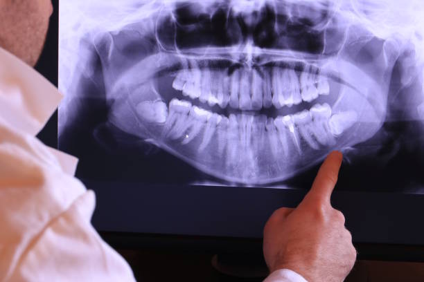 Best Pediatric Emergency Dentist in Cochituate, MA