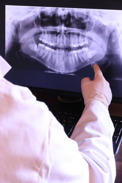 Best Emergency Gum Treatment in Cochituate, MA